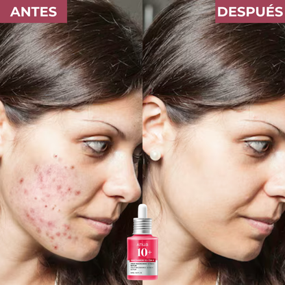 Serum Anti-manchas de Alta Potencia