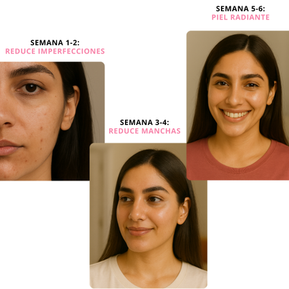 Masajeador facial de luz roja