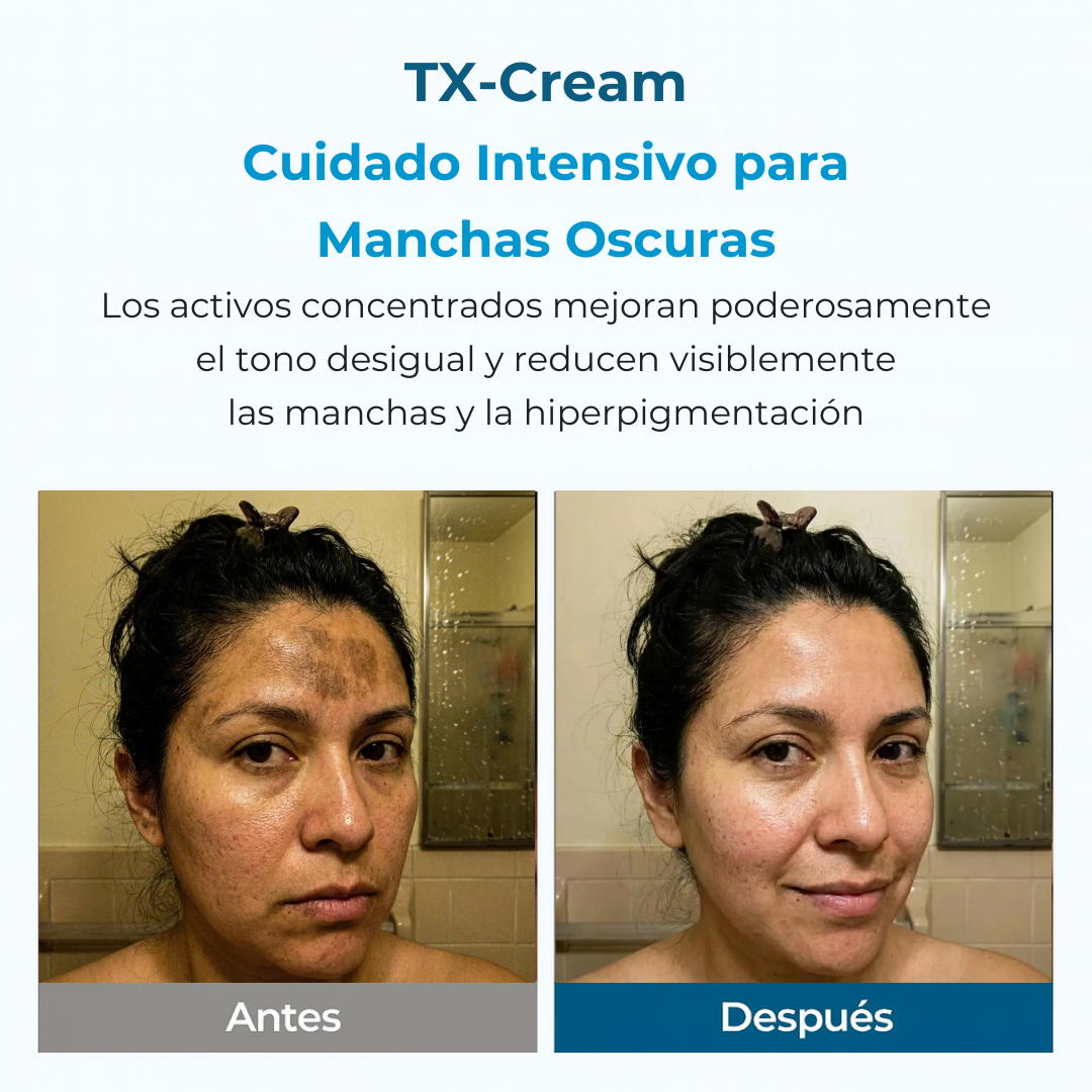TX Cream Tratamiento Anti-Manchas