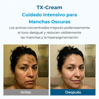 TX Cream Tratamiento Anti-Manchas