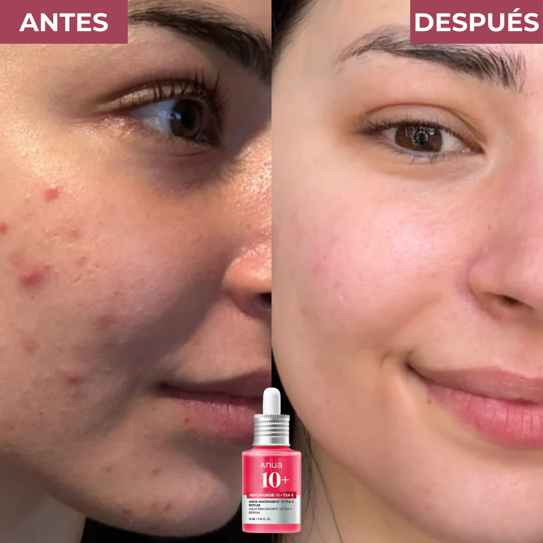 Serum Anti-manchas de Alta Potencia