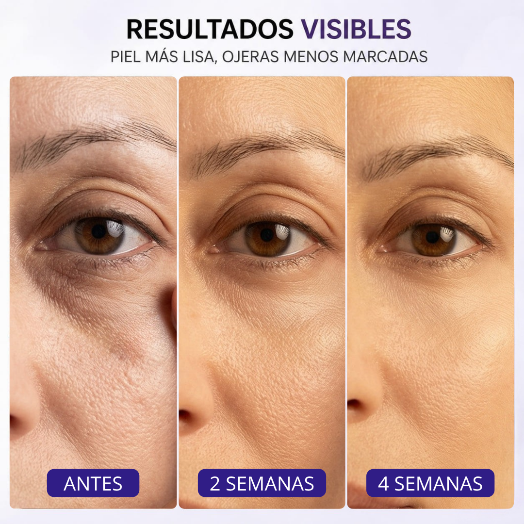 Reedle Shot - Contorno de ojos premium