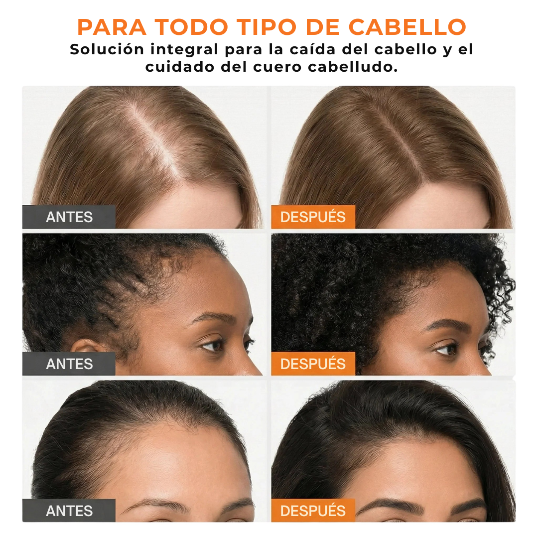 Sérum para el crecimiento del cabello- Lilyeve