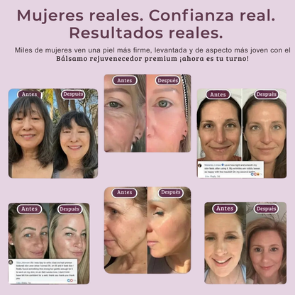 Bálsamo Rejuvenecedor premium