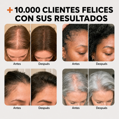 Sérum para el crecimiento del cabello- Lilyeve