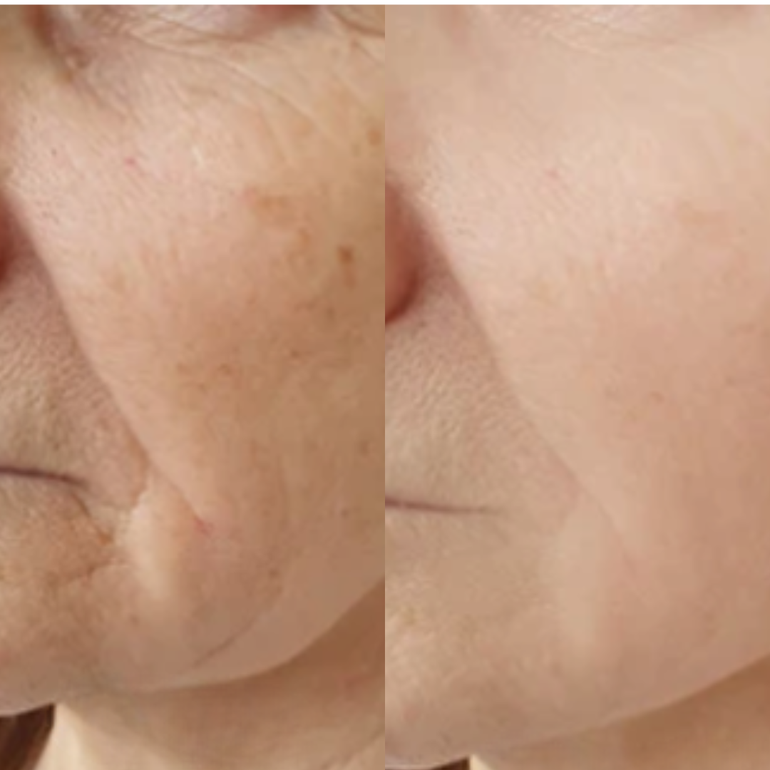 Booster Retinal Shot Antiarrugas